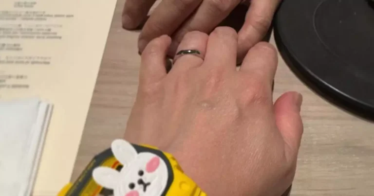 藝人阮小儀在社交媒體IG，上載一張手戴求婚戒指的閃亮照片。