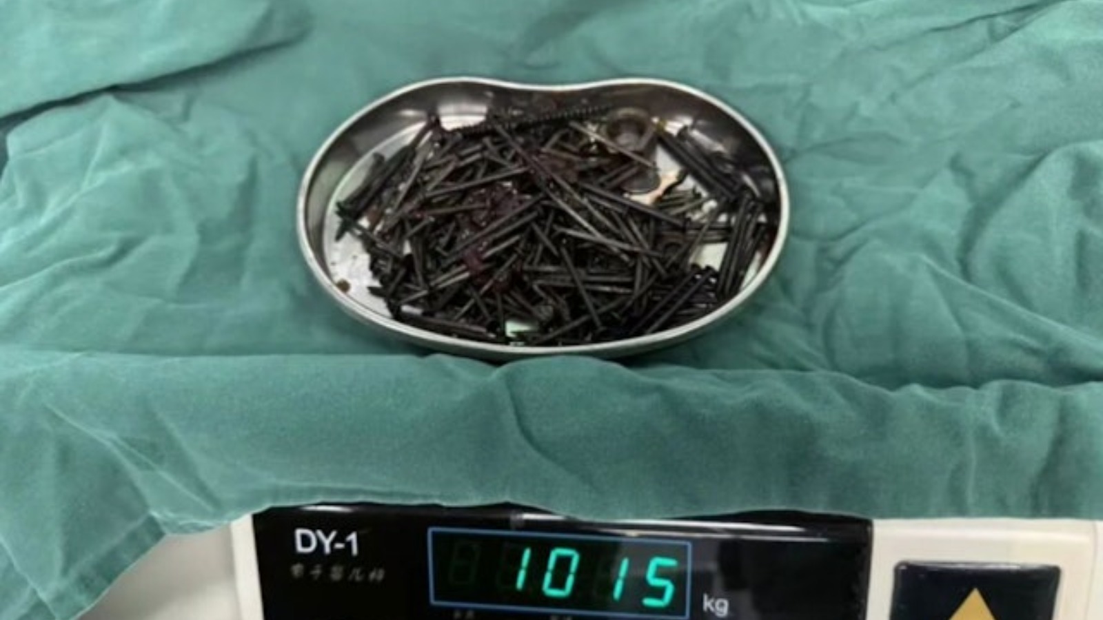 雲南男疑患異食癖　手術腹部取出181顆鐵釘重1公斤