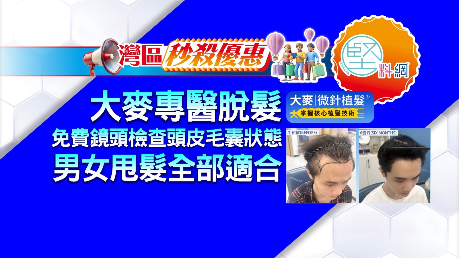 【灣區秒殺優惠】大麥專醫脫髮　免費鏡頭檢查頭皮毛囊狀態　男女甩髮全部適合